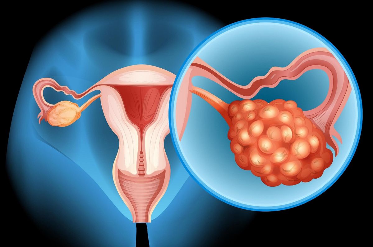 Ovarian Cancer Doctor in Dubai - Dr. Ajeet Tiwari