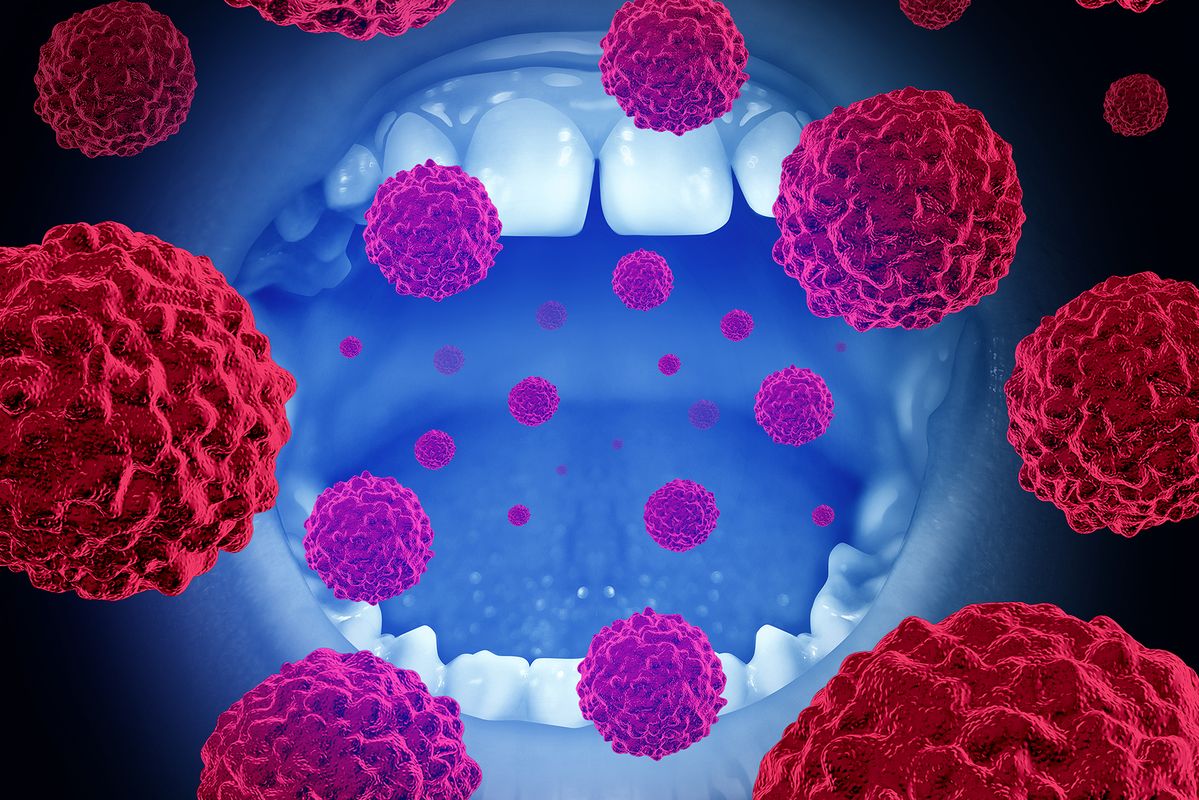 Oral Cancer Treatment Review for Dubai Patients - Dr. Ajeet Tiwari