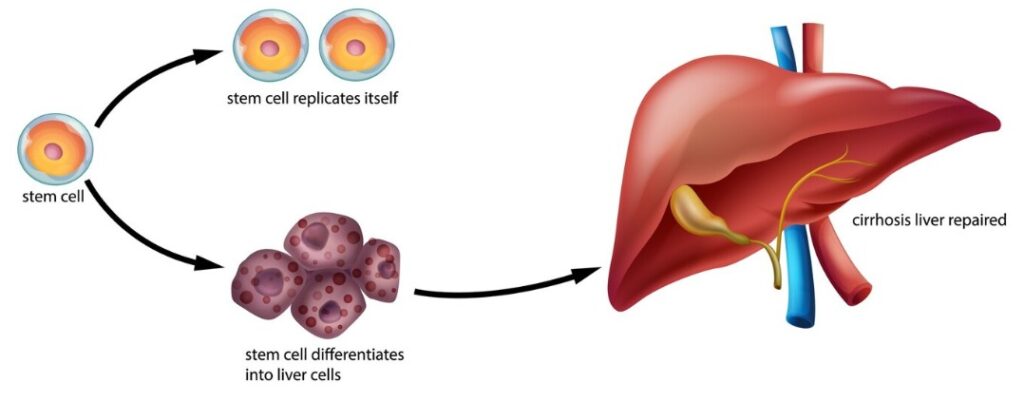 Best Doctor for Gallbladder Cancer in Dehradun